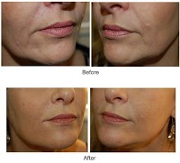 Norwich botox, fillers and laser clinic 380241 Image 2